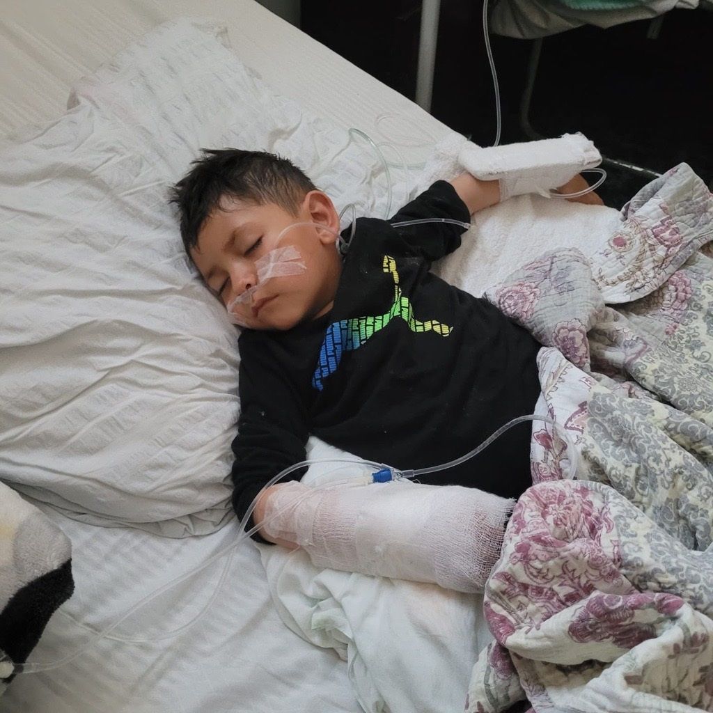 Eight-year-old Dylan in Guatemala who is in need of medical support. (Supplied)